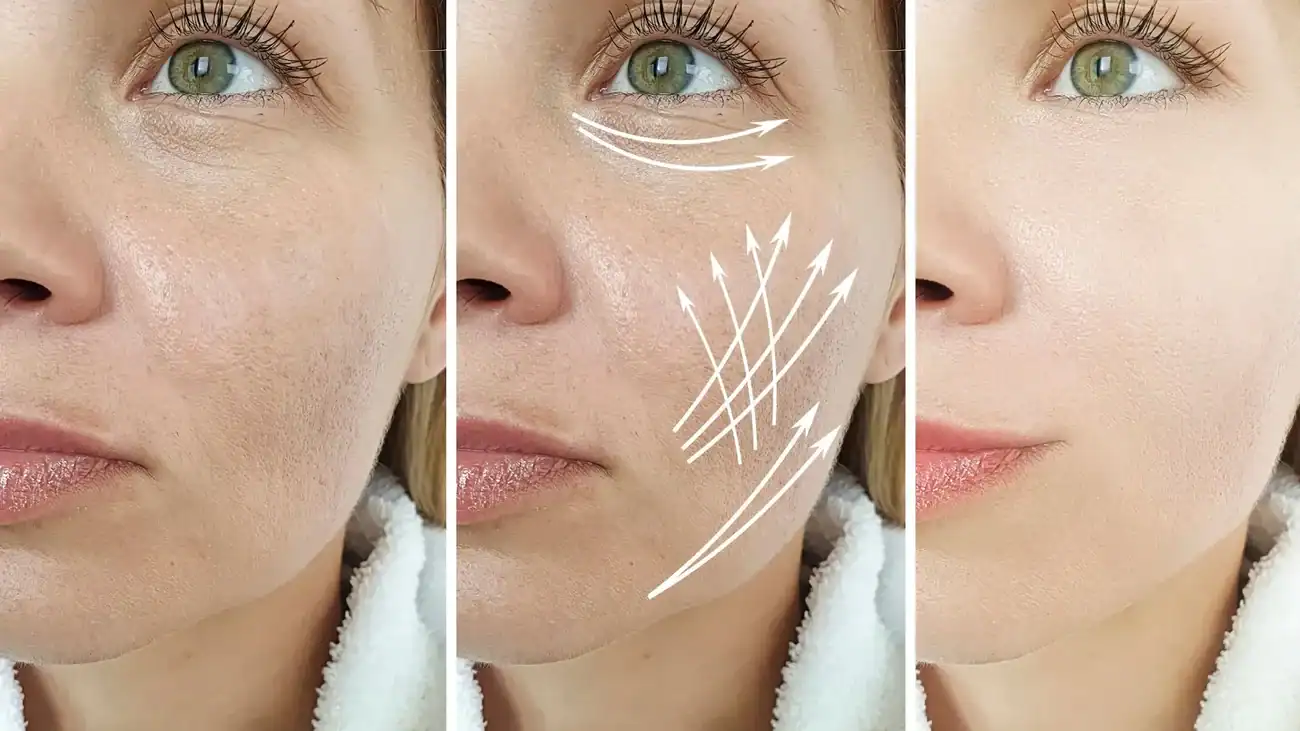 Can One Treatment Really Tackle More Than One Skin Concern Nottingham?
