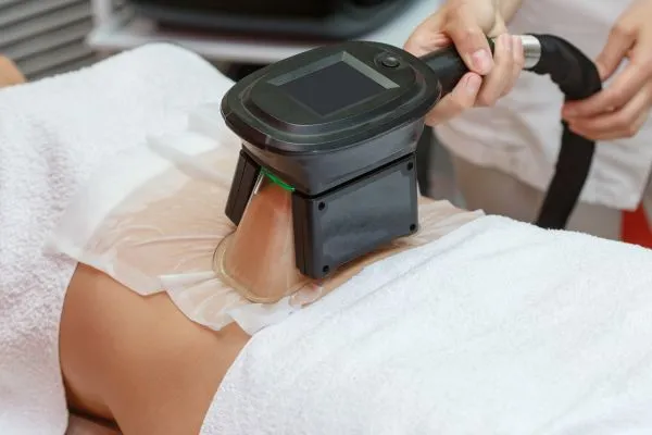 Image of person having fat freezing treatment to help weight gain Nottingham