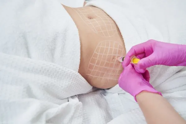 image of fat dissolving injections on love handles to help combat weight gain Nottingham