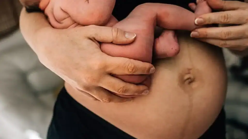 Why Is My Stomach Still Big After Pregnancy Nottingham?